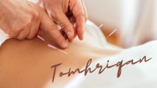 トリガーポイント鍼療法：痛みの根本治療へのアプローチ 